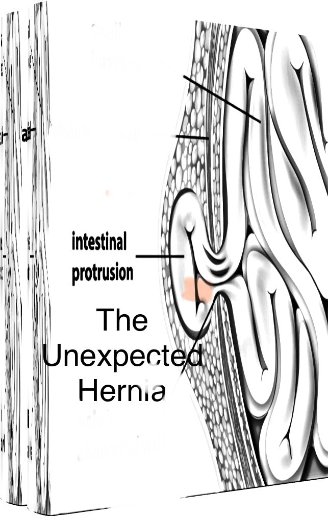 The Unexpected Hernia